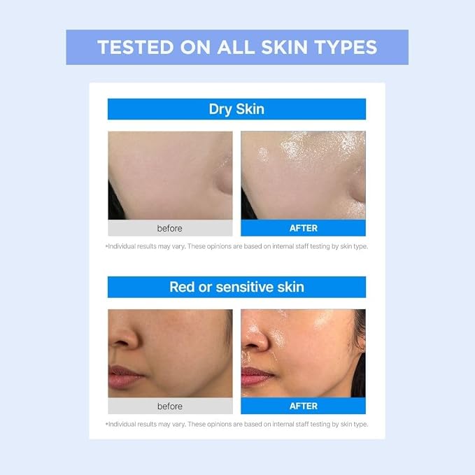Hyaluronic Acid