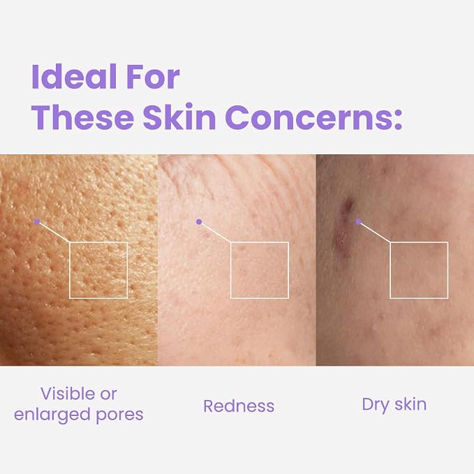 Retinol Complex (Youthful Glow)