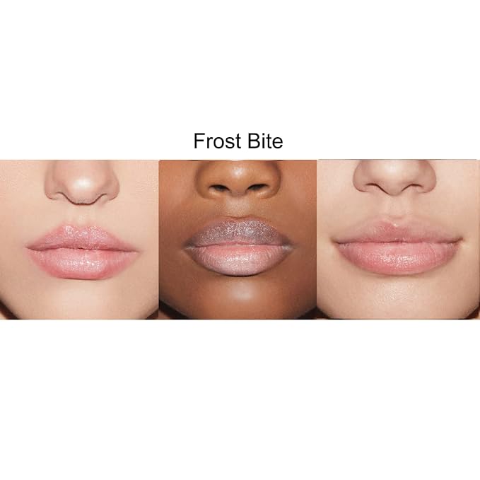 Frost Bite
