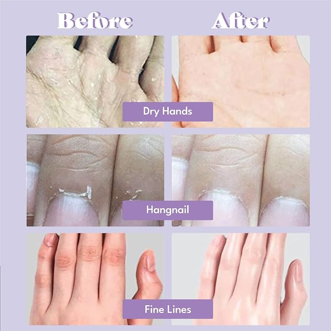 Moisturizing Gloves-5pairs