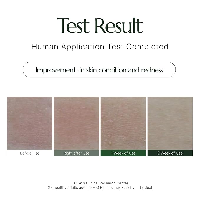 ACNE CARE