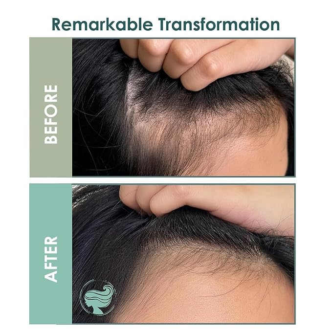 Full & Thick Hair Essence