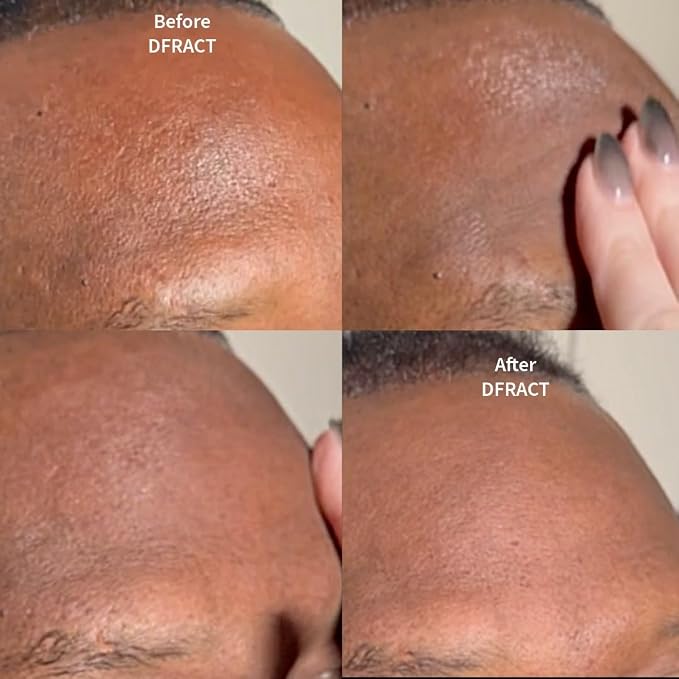 __DEFAULT__