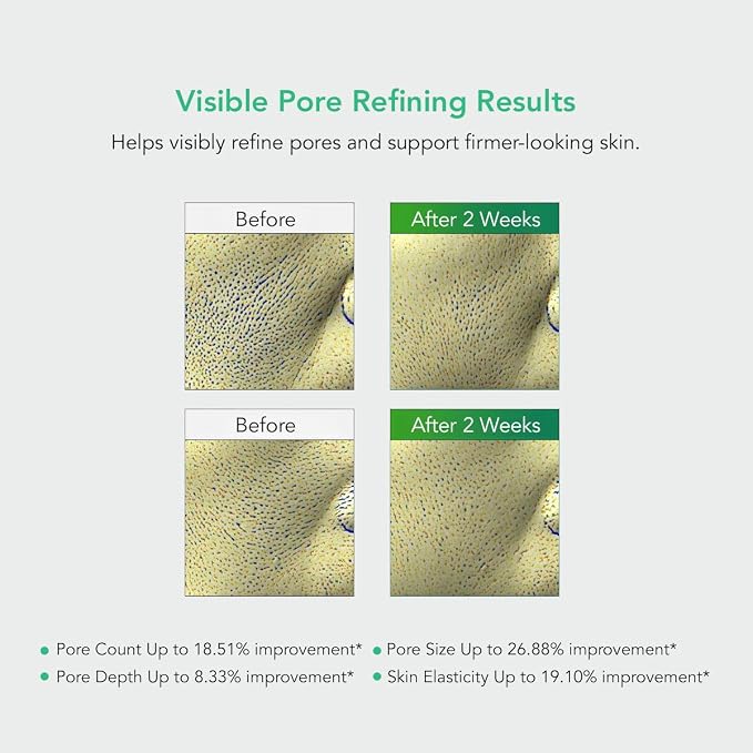 Pore Tightening Pads