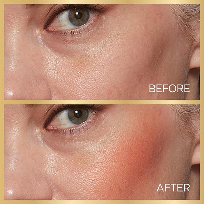 Berry