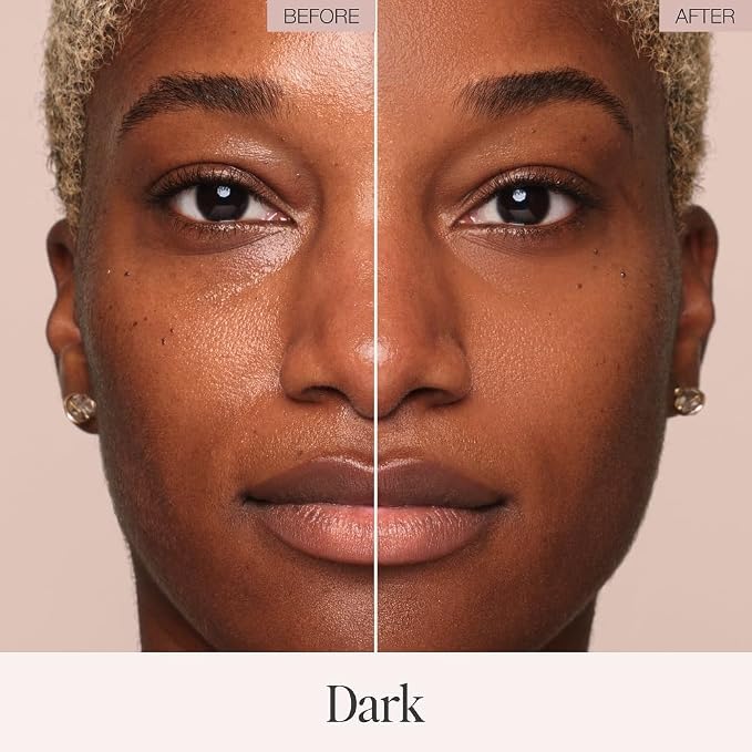 06 Dark-Dark skin with golden undertones