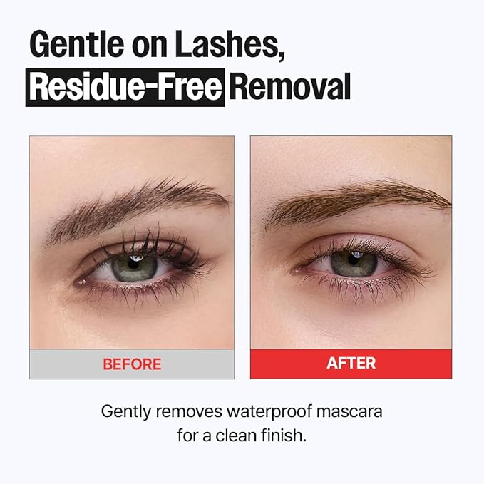 Remover