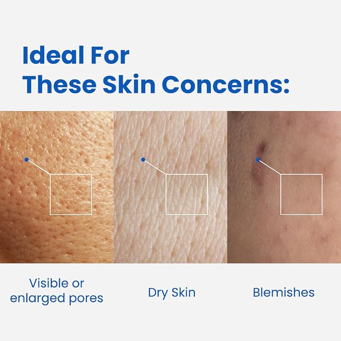 Hyaluronic Acid Microshot