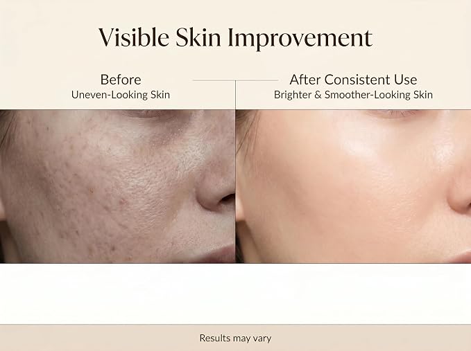 Niacinamide