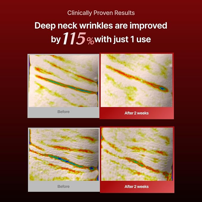 Neck Mask