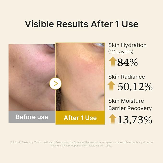 Kojic Acid Turmeric