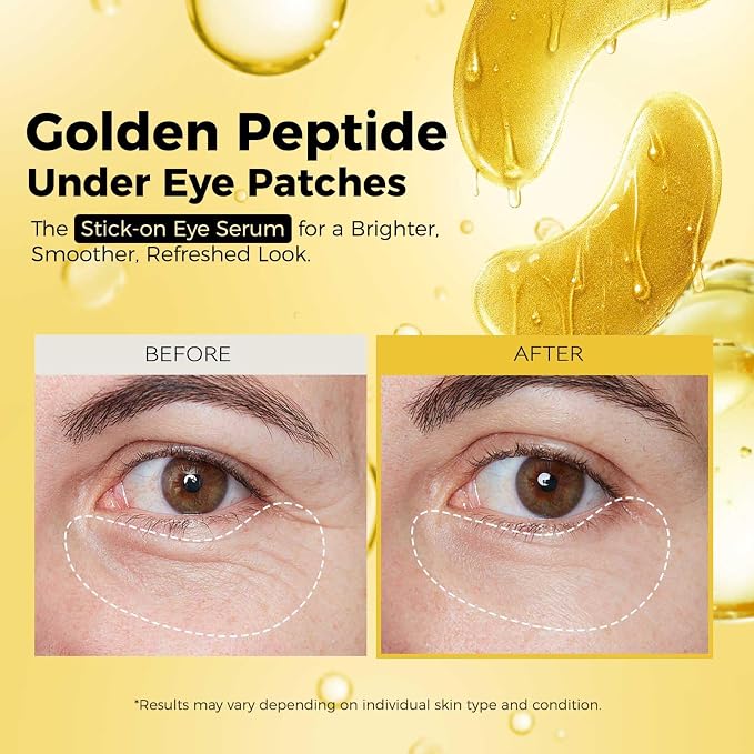 Golden (24 Paris)