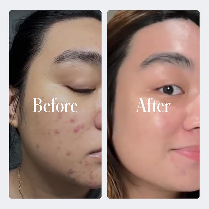 __DEFAULT__