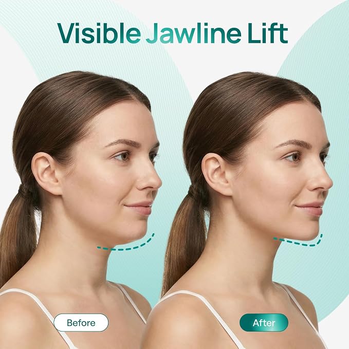 V-Line Masks 15 Pack