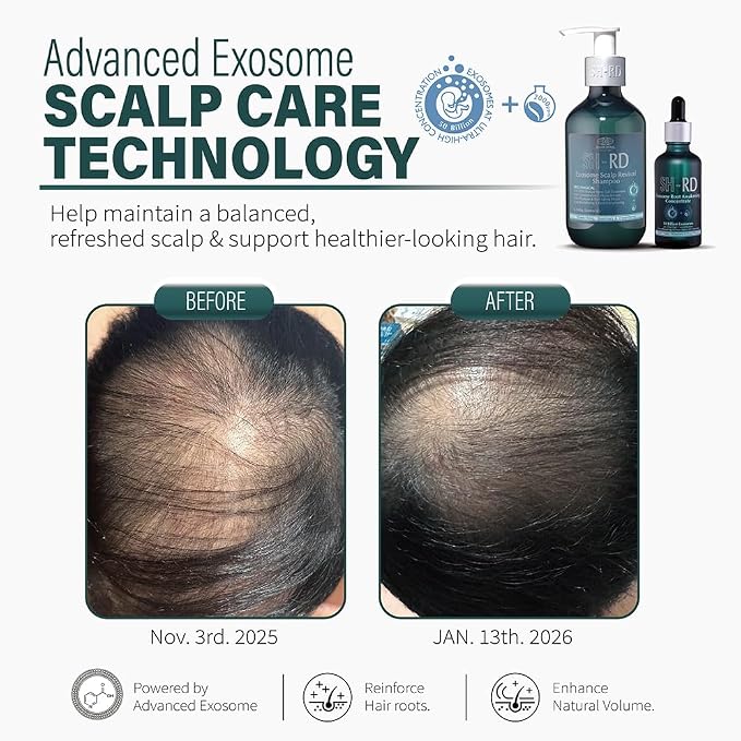 Exosome Root Awakening Concentrate