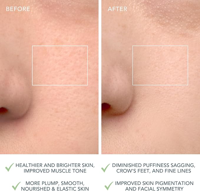 Combination Skin