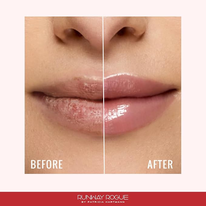 Lip Treatment