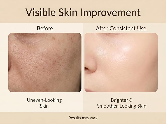 Niacinamide