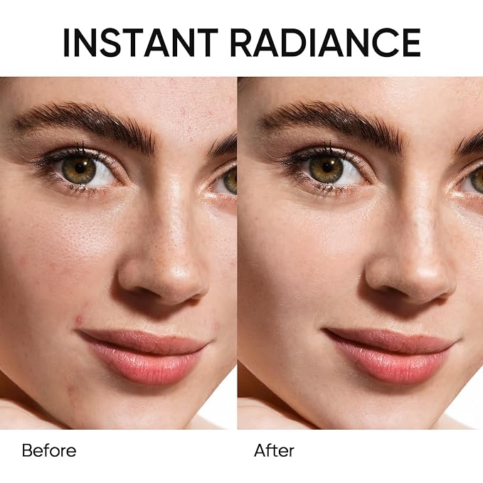 Niacinamide Clay