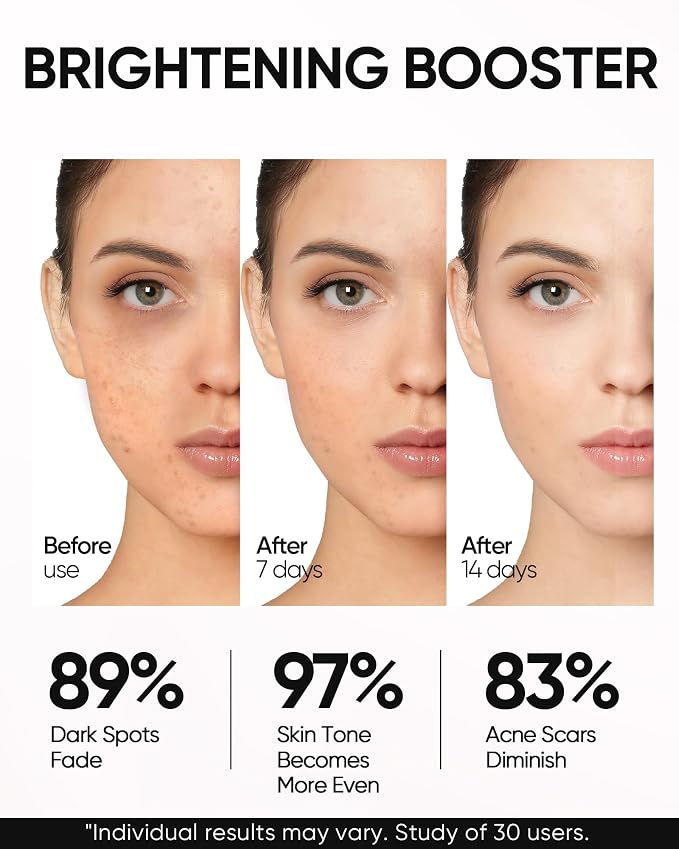 Niacinamide