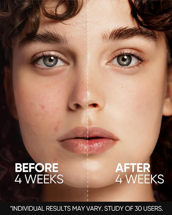 Retinol