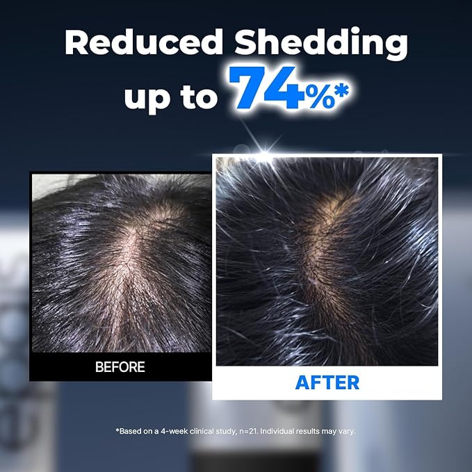 Full Scalp Care (Pack of 3)