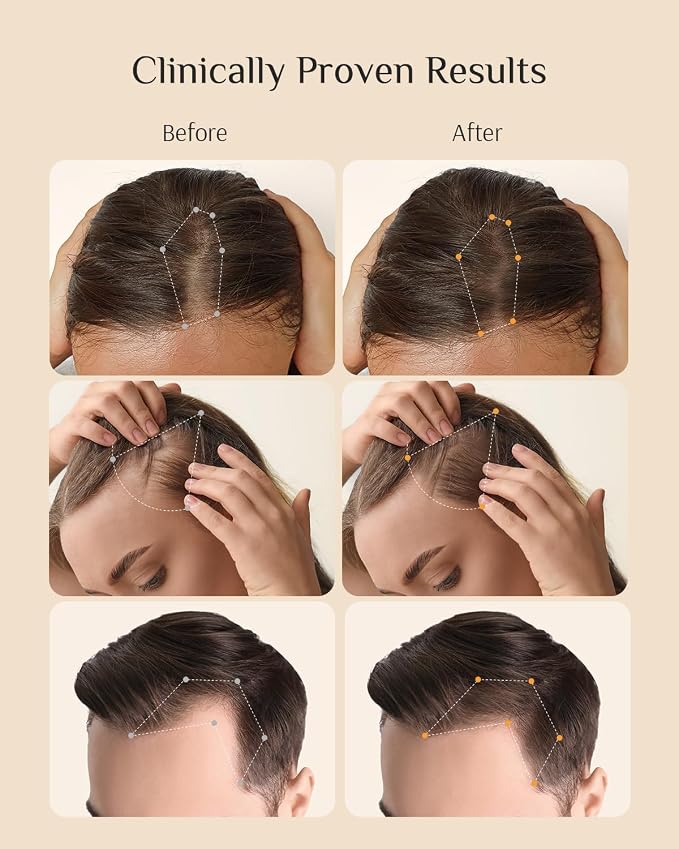 A-Redenical Conditioner
