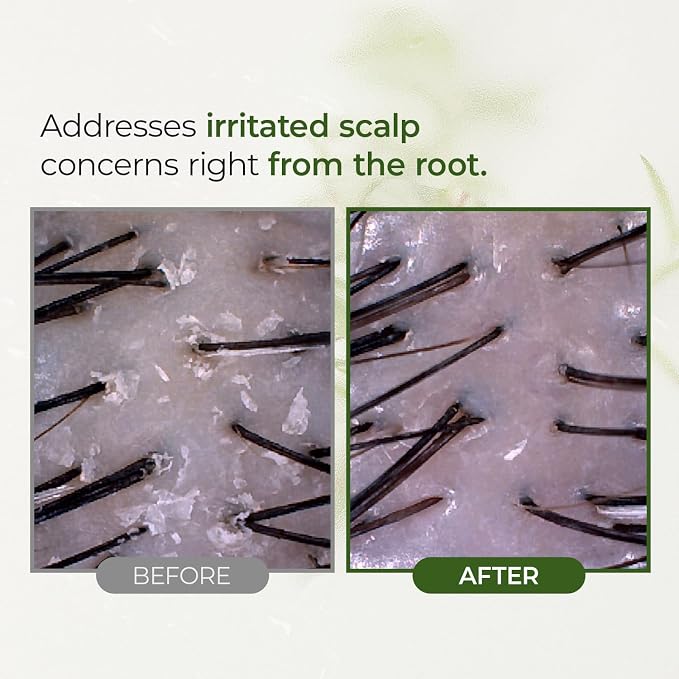 Tea Tree Scalp Water Scaler Miniature, 1.69 fl oz