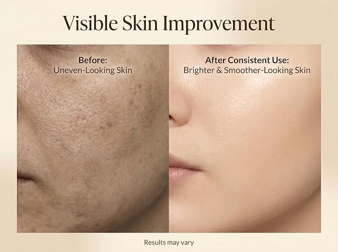 Niacinamide