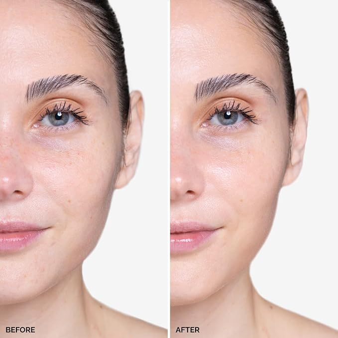 Dewy