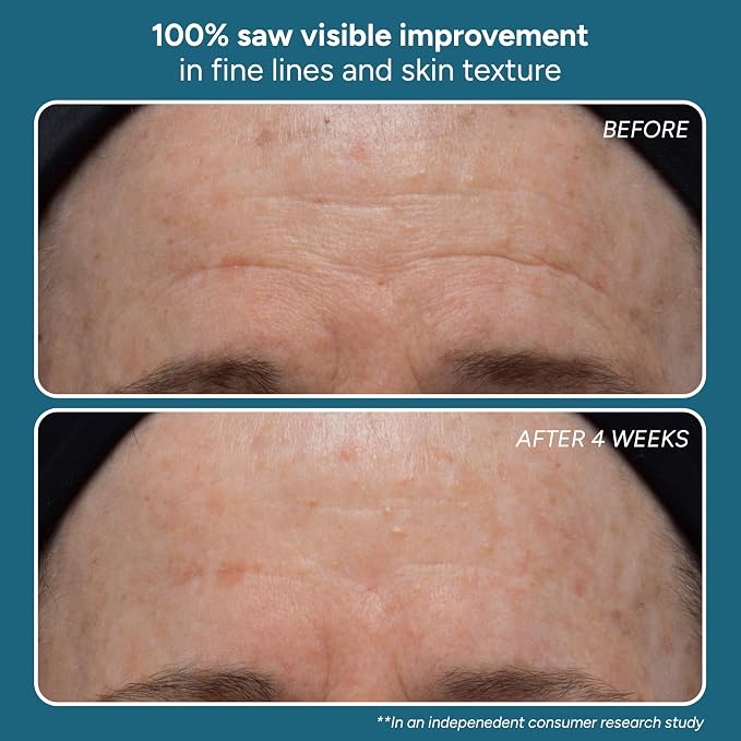 Normal-Combination Skin