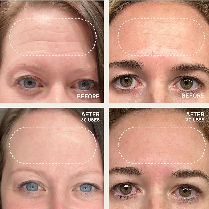 Forehead Patch