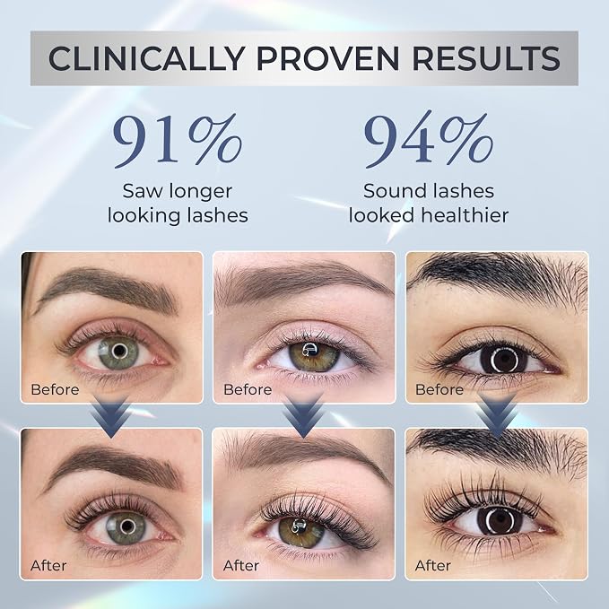 1. Serum
