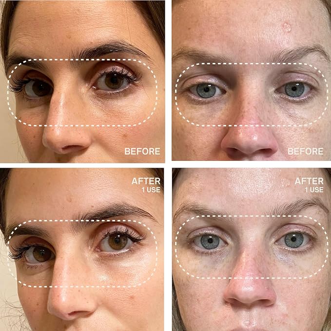 Eyes & Mouth Patches