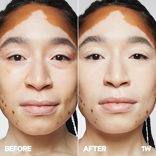 01W - Very Fair with Warm Undertones