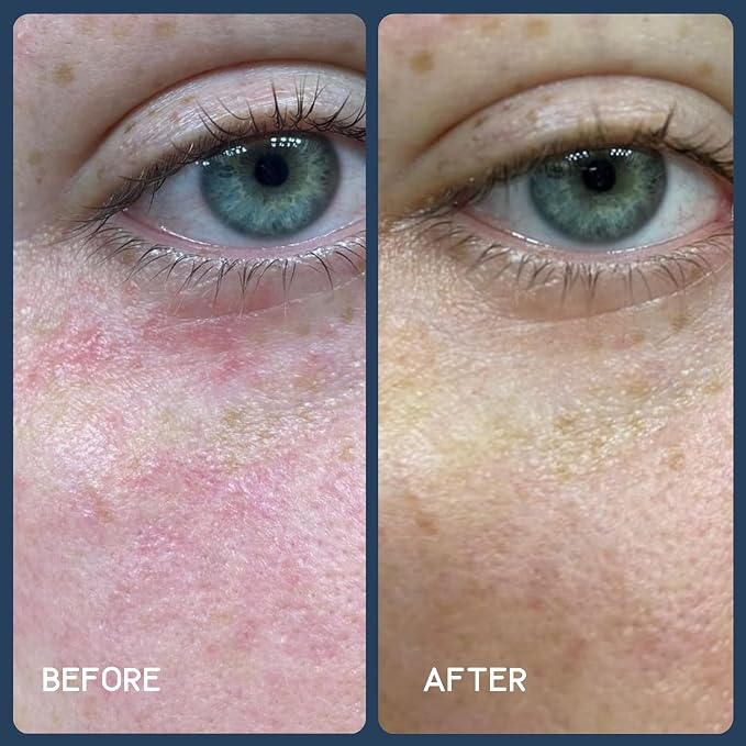 Clear Daily Sunshine Serum + Liposomal Copper Peptides 1%