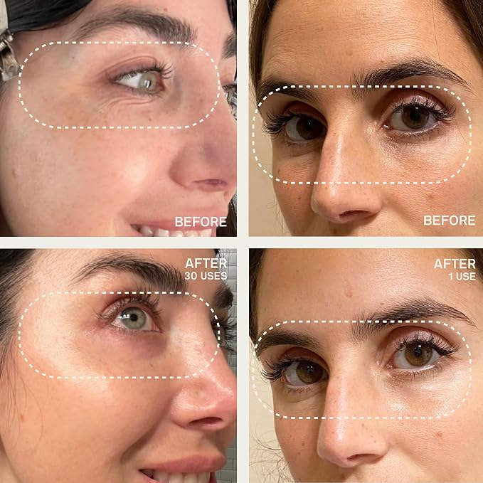 Forehead and Eyes & Mouth Patches