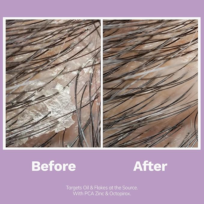 Oil Control Shampoo