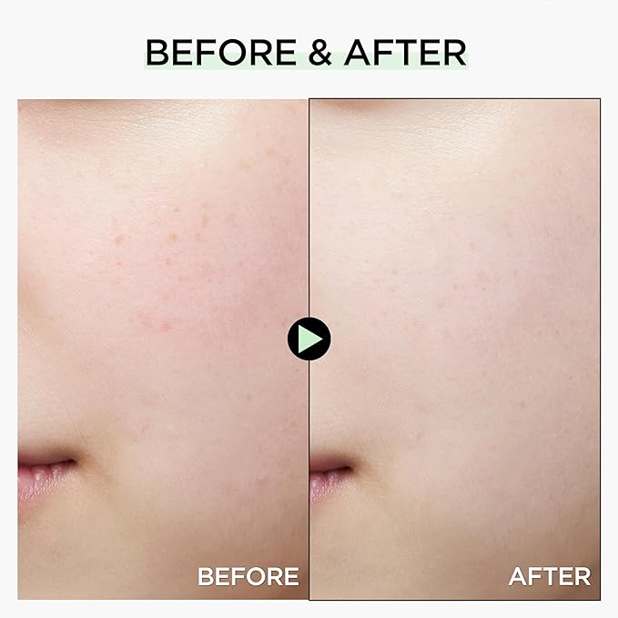 Tone Correcting