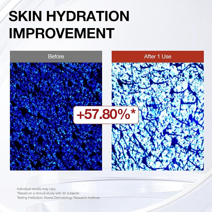 Hydro Relief