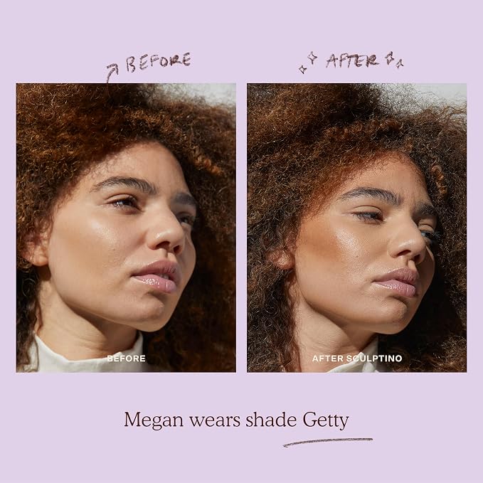 Getty