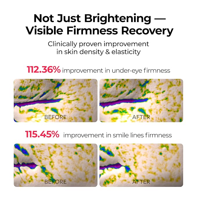 TXA