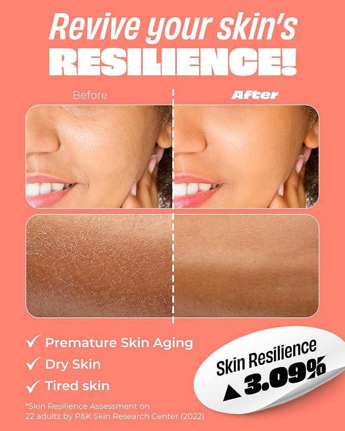 collagen
