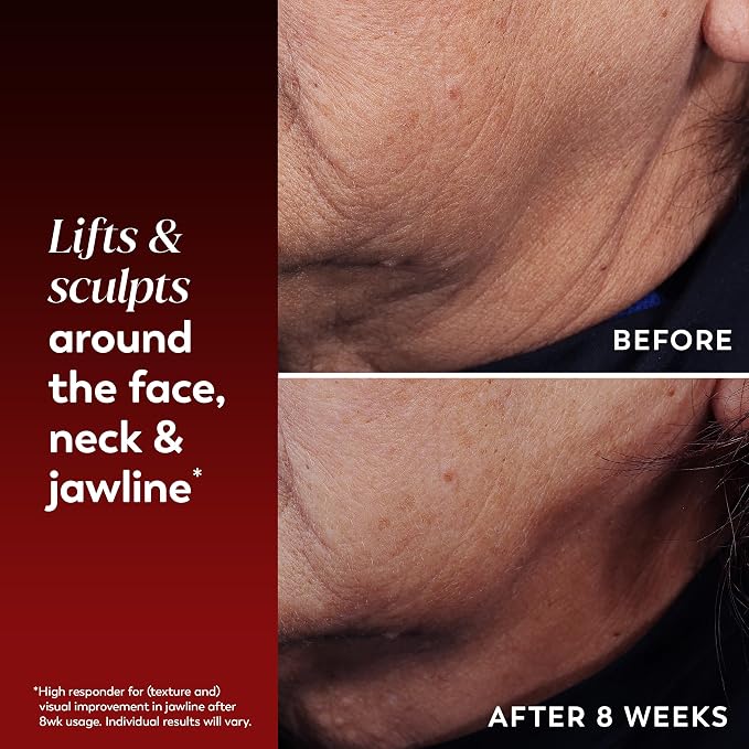 Face Lifting Treatment