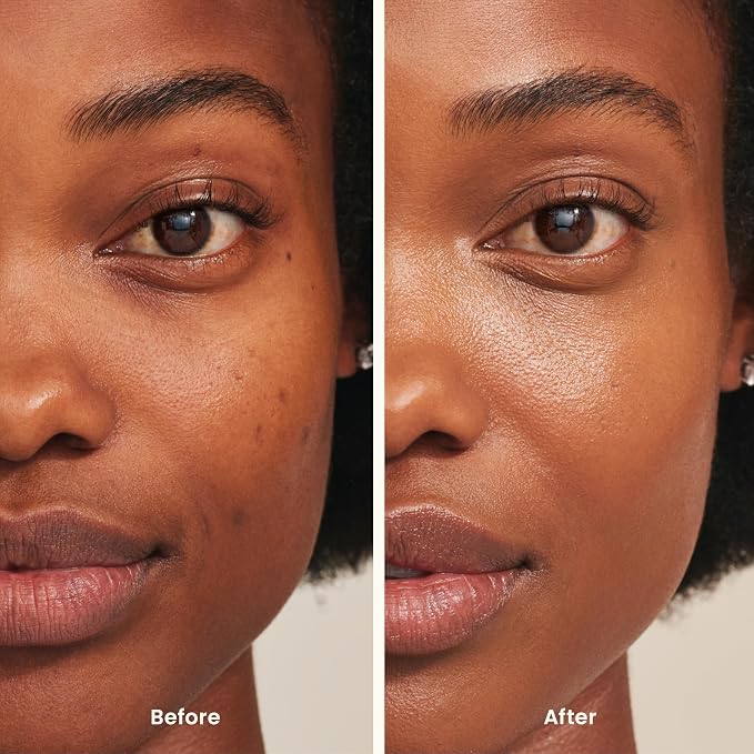 Medium with Warm Undertones