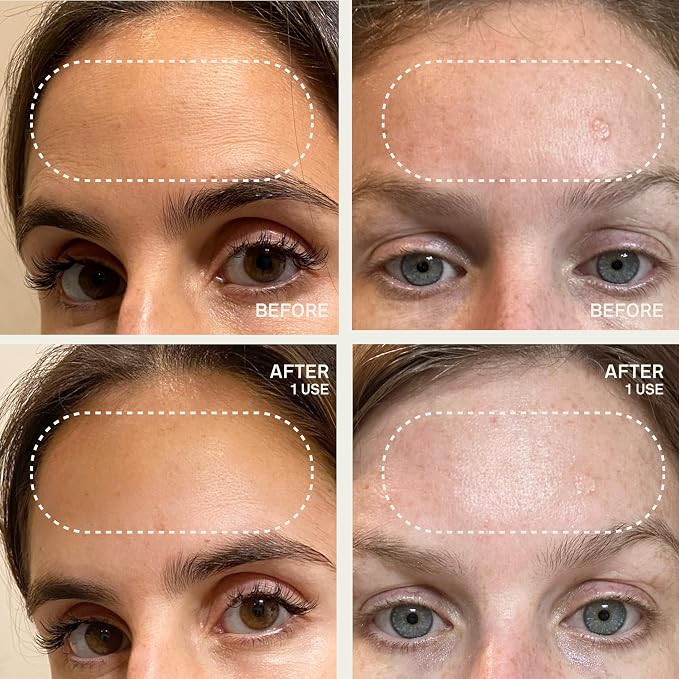 Forehead Patch